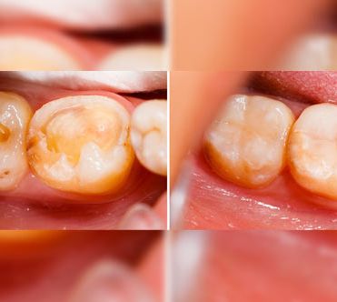 Costa & García Clínica Dental tratamiento dental 