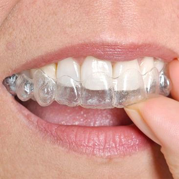 Costa & García Clínica Dental ortodoncia invisible 
