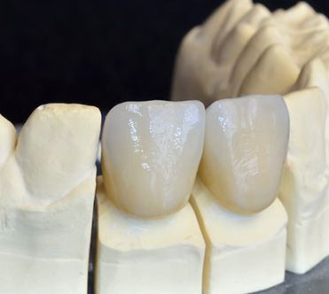 Costa & García Clínica Dental dientes